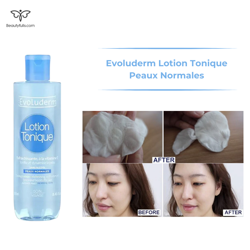 evoluderm-peaux-normales-lotion