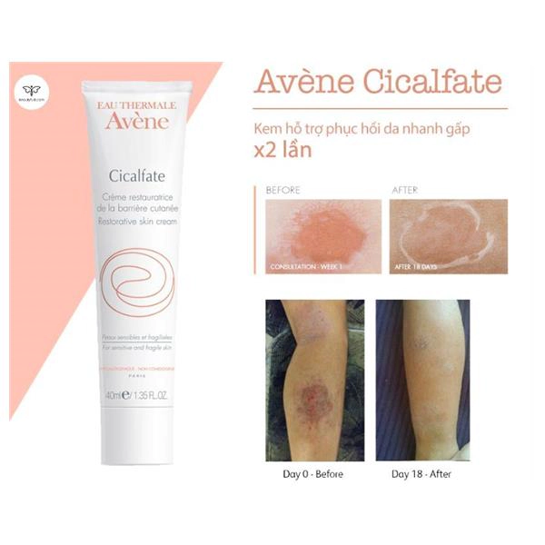 Kem dưỡng ẩm Avene Cicalfate Repair Cream 